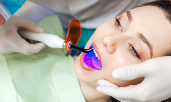 AS Teeth Whitening Treatment